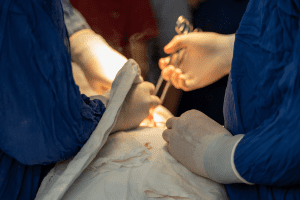 surgery-smoke-surgeons