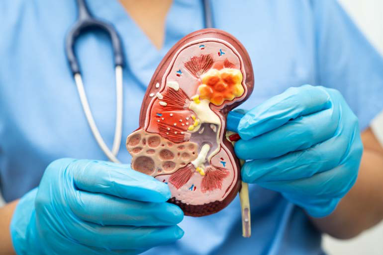 Kidney model held by a clinician